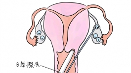 小儿退烧推拿手法 5种西安捐卵宝宝退烧按摩方法